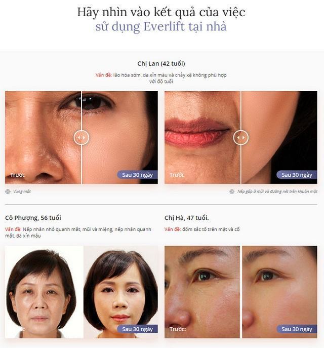 EVERLIFT là một sản phẩm chăm sóc sắc đẹp nhắm đến đối tượng là chị em phụ nữ